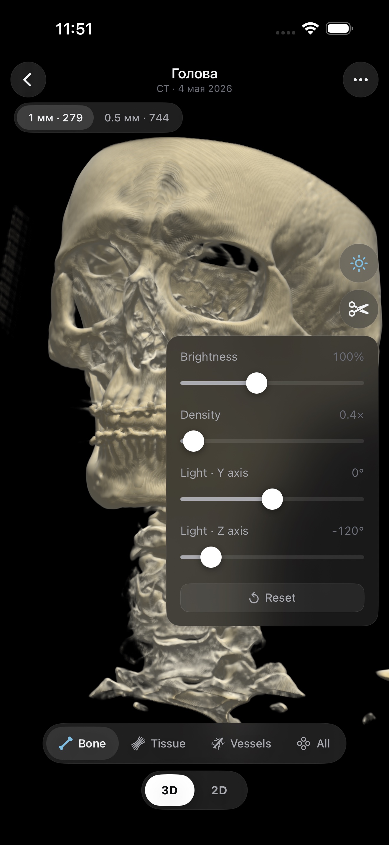 LumaDICOM — 3D CT reconstruction of a skull with on-screen brightness, density and light controls