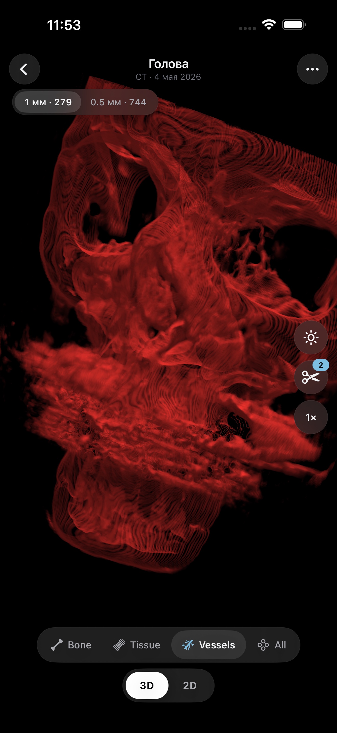 Vessels preset rendered in red