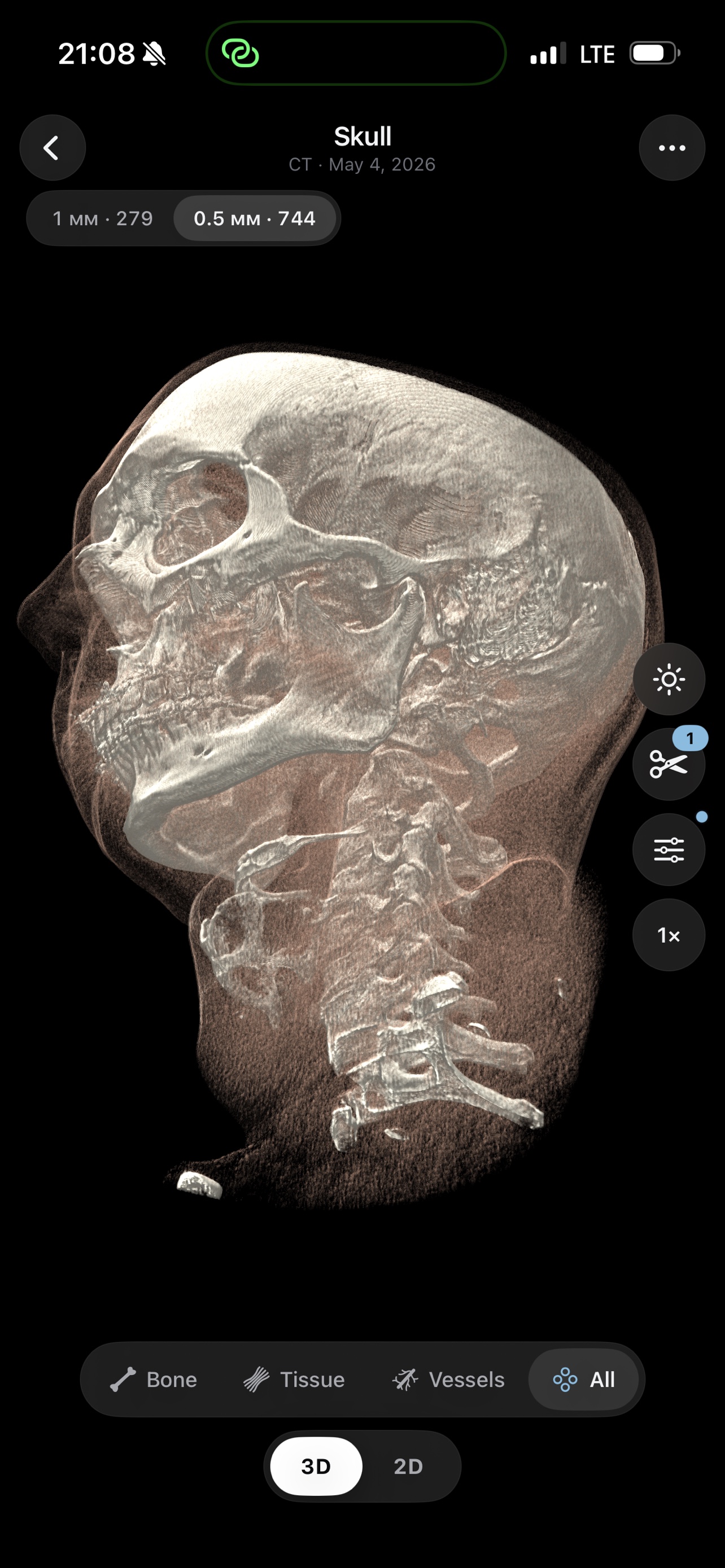 3D CT reconstruction of a skull in profile